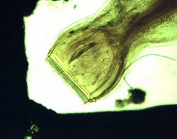 Photograph of a nematode