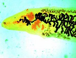 Photograph of a trematode