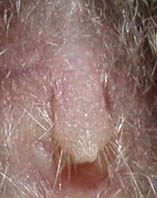 Photograph of a club-shaped penis