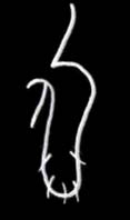 Diagram of a parallel-sided penis